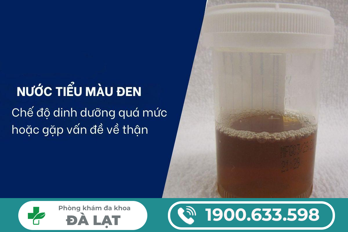 Hình ảnh minh họa